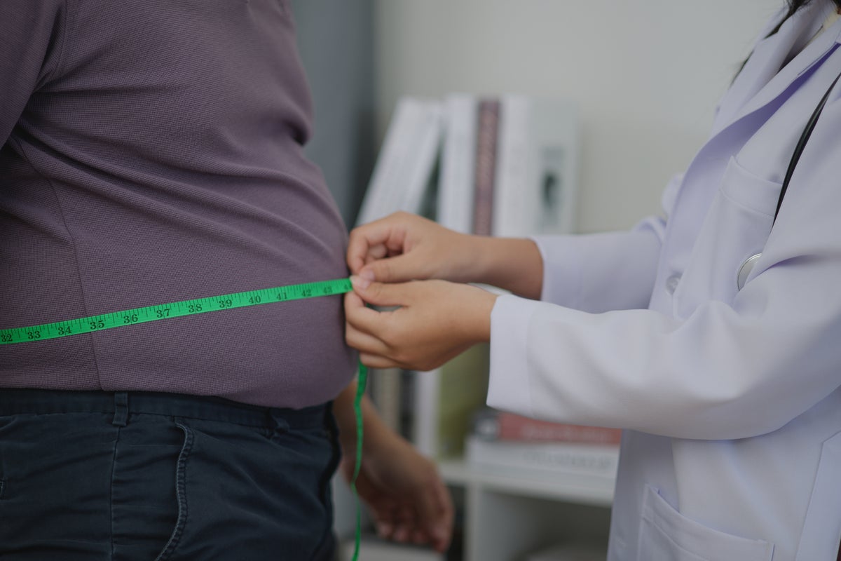 Human Brain Defends Past Higher Body Weights to Resist Weight Loss